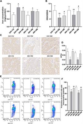 Integration of transcriptomics and metabolomics reveals the molecular mechanisms underlying the effect of nafamostat mesylate on rhabdomyolysis-induced acute kidney injury